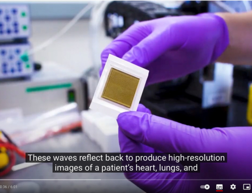 A postage stamp-sized patch provides ultrasound images from the body